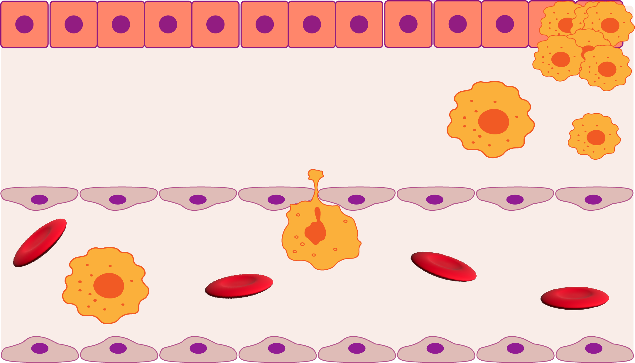 Cancer Metastasis